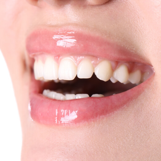 Close-up of young woman's smile