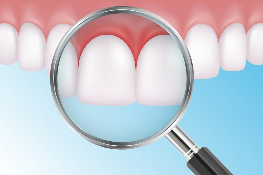 Virtual model of healthy teeth